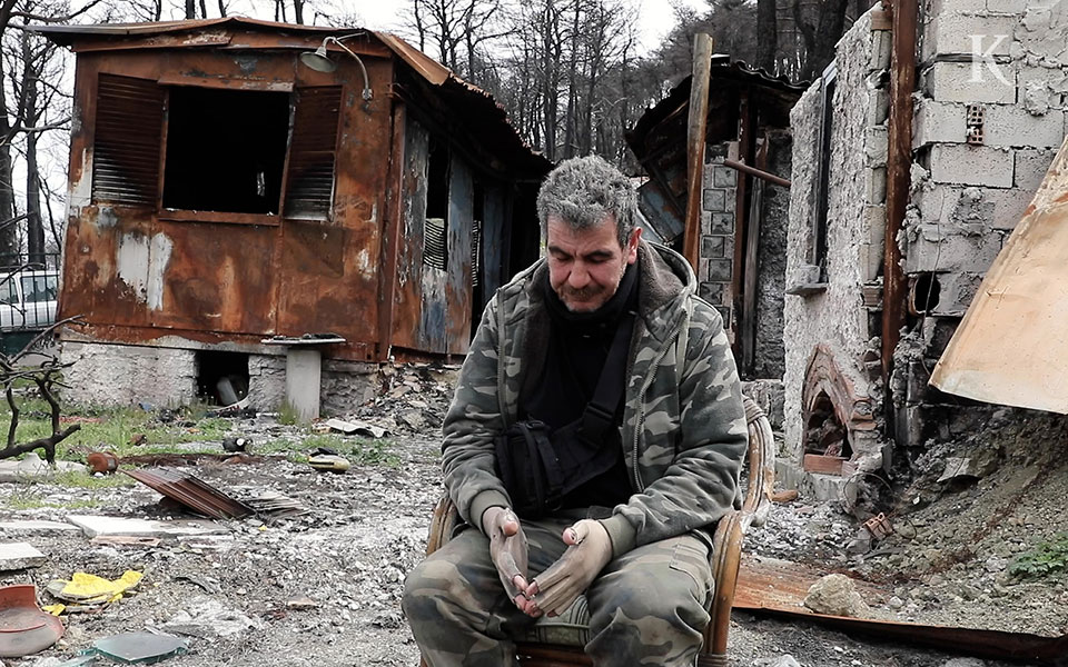 έγκαυμα-η-στήριξη-μετά-το-εξιτήριο-561817012