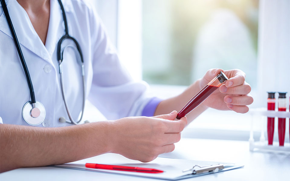 ομάδα-αίματος-πώς-σχετίζεται-με-τον-κί-561817975