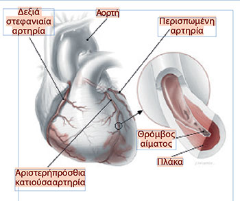 Παρατηρώντας τις στεφανιαίες αρτηρίες-1