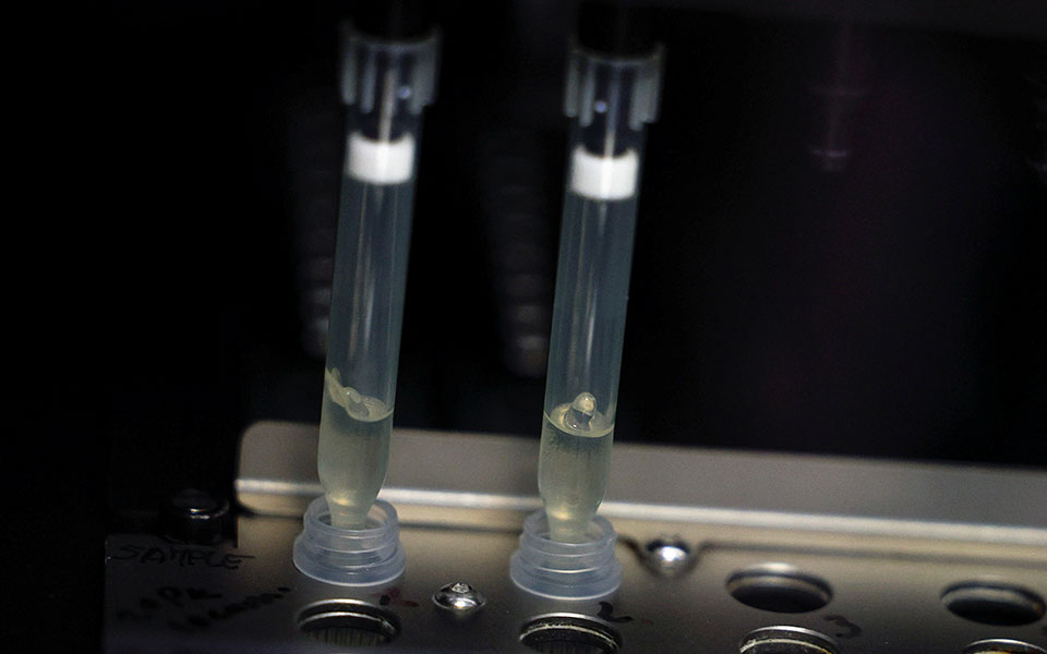 ευλογιά-των-πιθήκων-στα-33-τα-κρούσματα-561890776