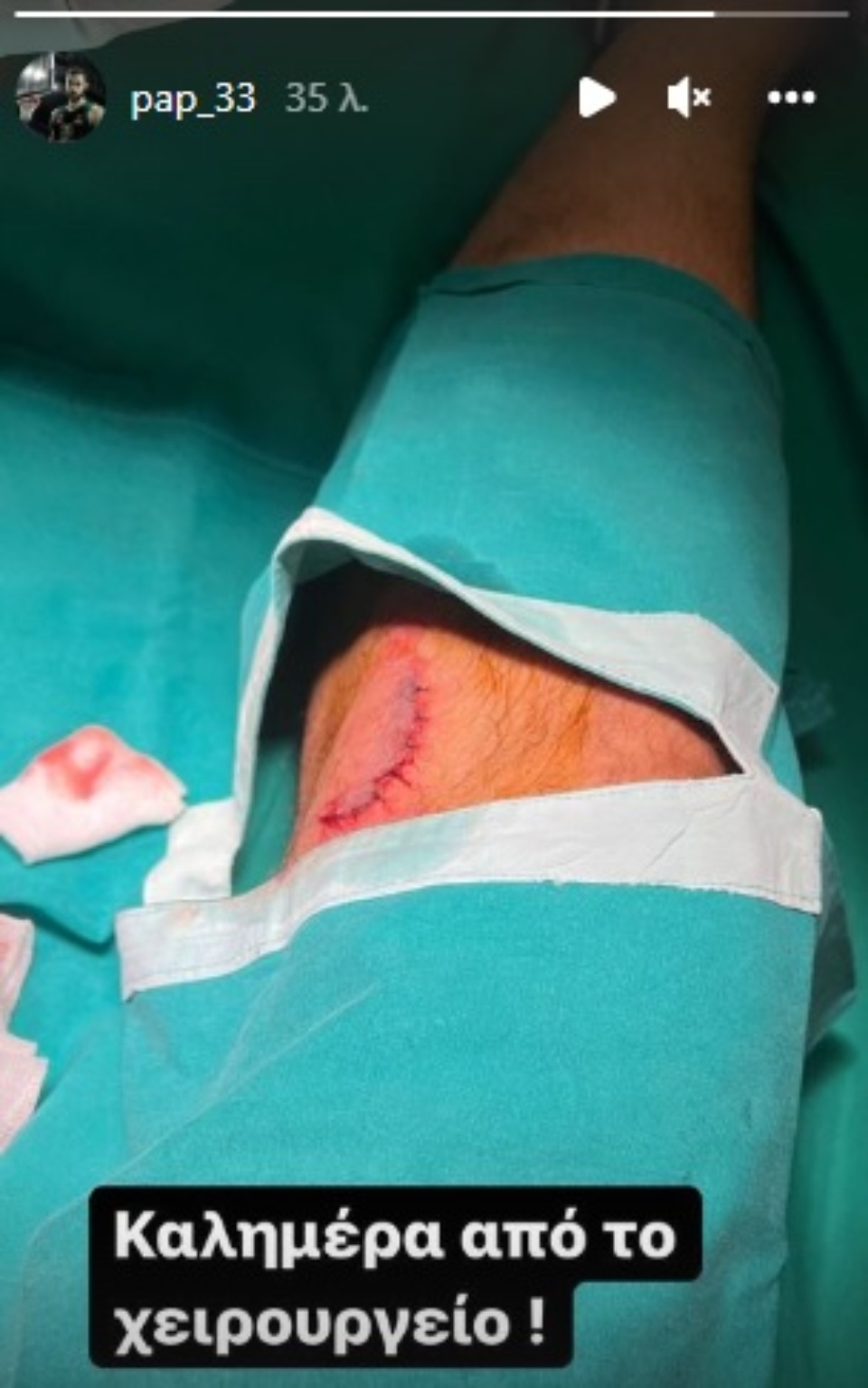 Παναθηναϊκός: Χειρουργήθηκε ο Παπαπέτρου-1