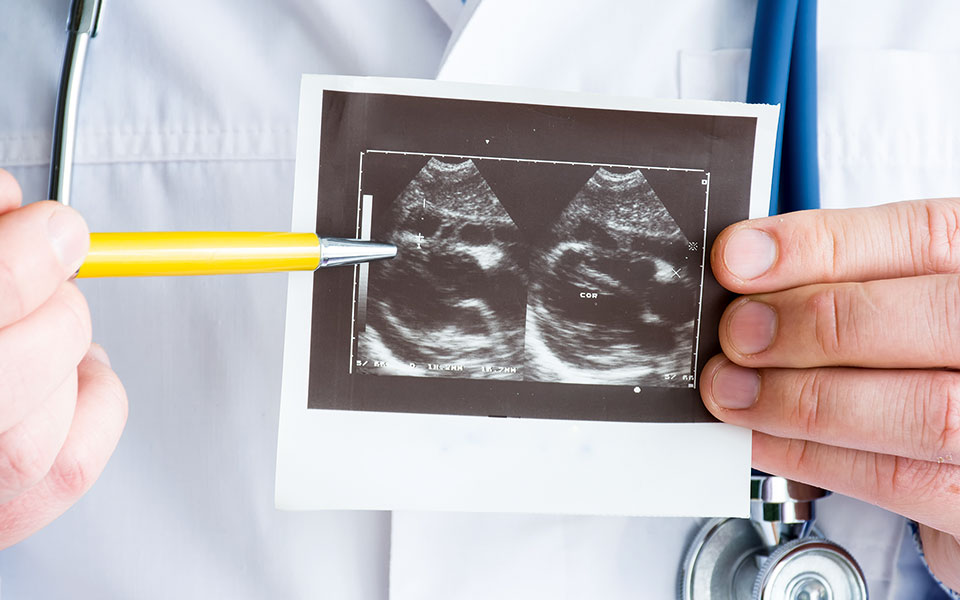 oταν-μια-λοίμωξη-προσβάλλει-την-καρδιά-561907720