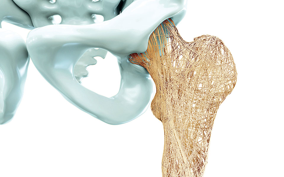 Μελετώντας την οστεοπόρωση-1