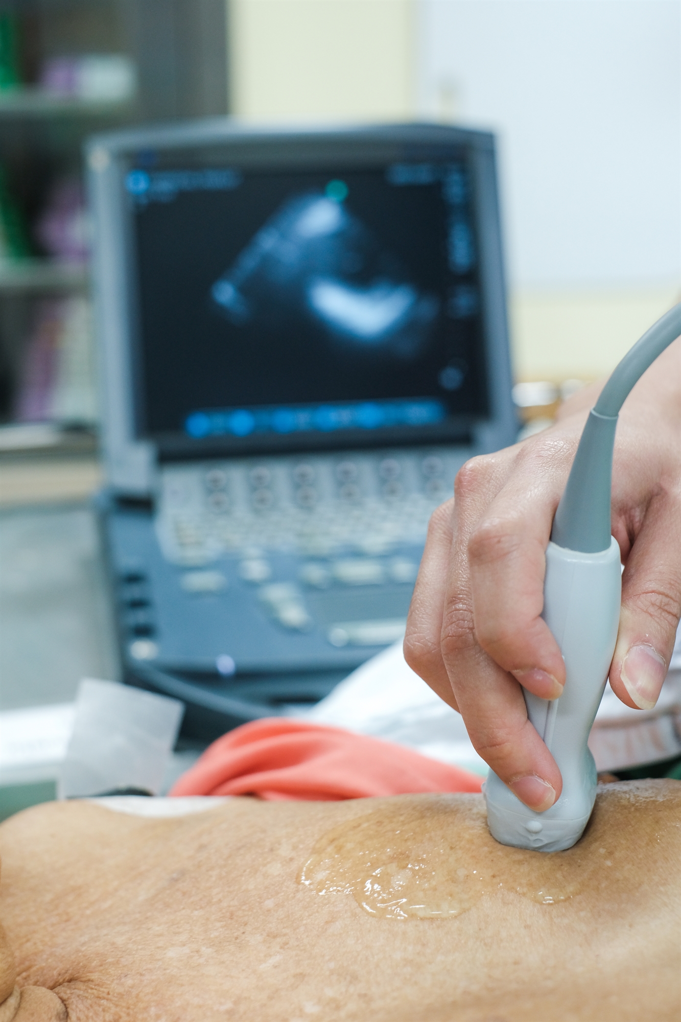 Χρειάζεστε πράγματι αυτή την καρδιολογική εξέταση ή επέμβαση;-1