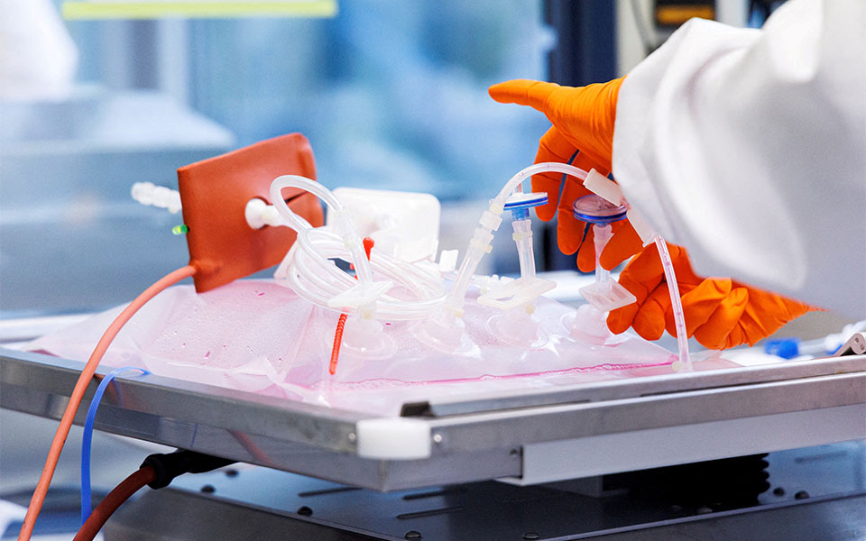 ευλογιά-των-πιθήκων-πρώτος-θάνατος-λό-561979114