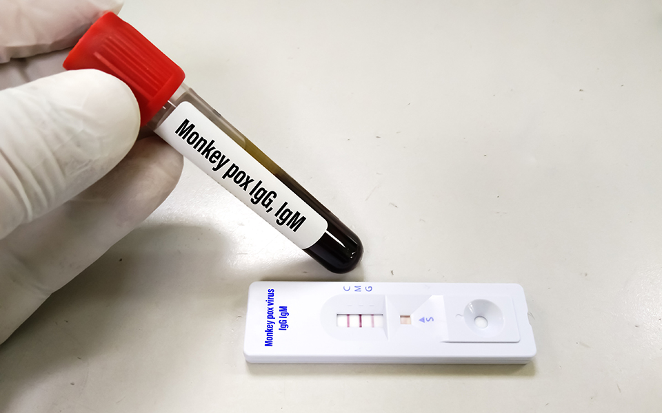 αρχόμενη-επιδημία-η-ευλογιά-των-πιθ-561981022