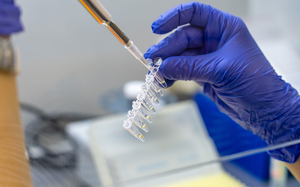 ευλογιά-των-πιθήκων-80-τα-κρούσματα-στη-562019104