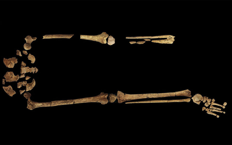 η-πρώιμη-αυγή-της-χειρουργικής-ο-πρώτο-562031872