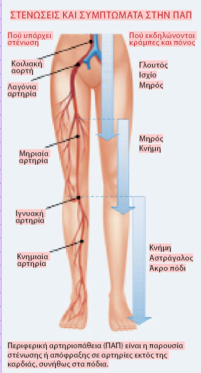 Oταν το περπάτημα προκαλεί πόνο στα πόδια-1