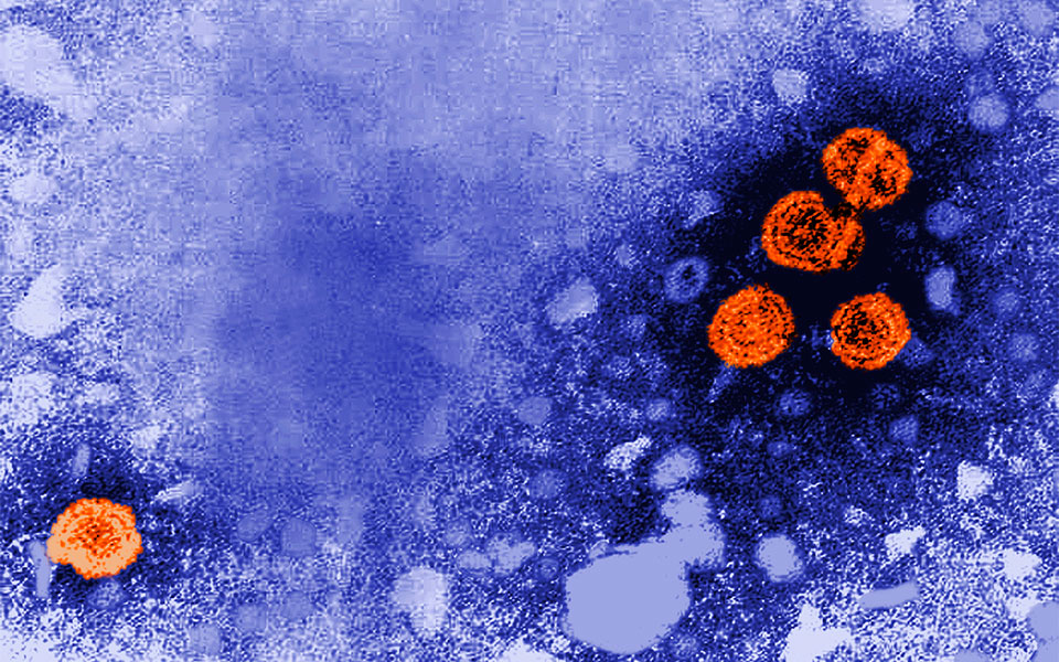 ecdc-μεγάλος-αριθμός-κρουσμάτων-ηπατίτι-562069798