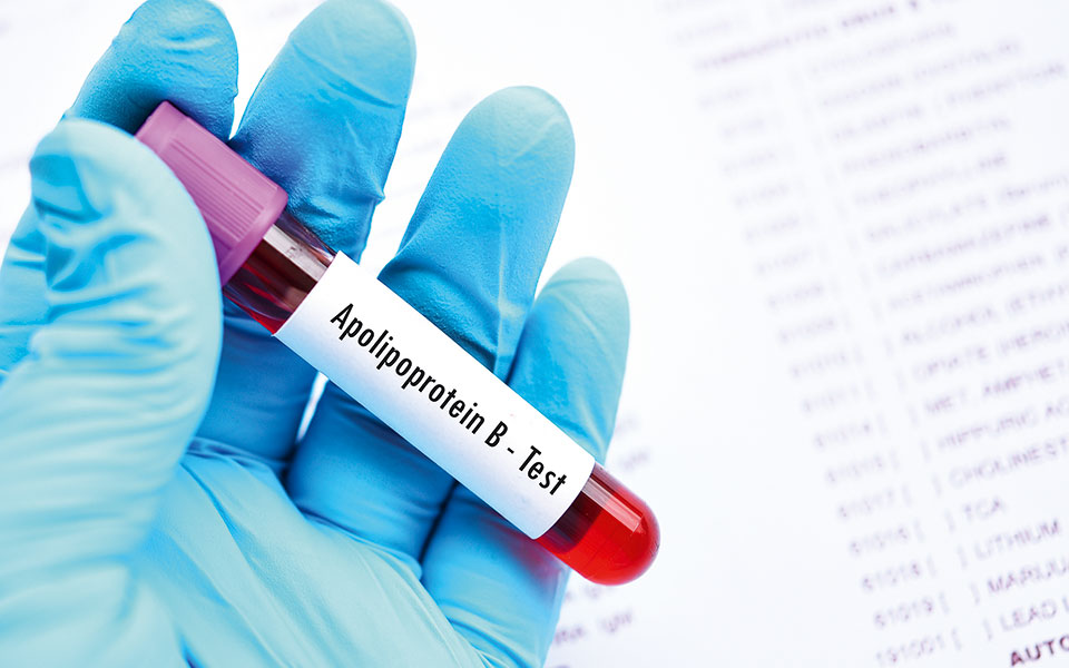 πέρα-από-την-κακή-χοληστερόλη-μια-πι-562068007