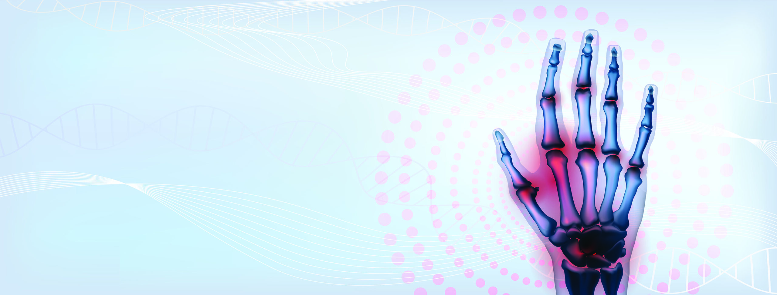 εντοπισμός-της-αρθρίτιδας-στους-αντ-562161373