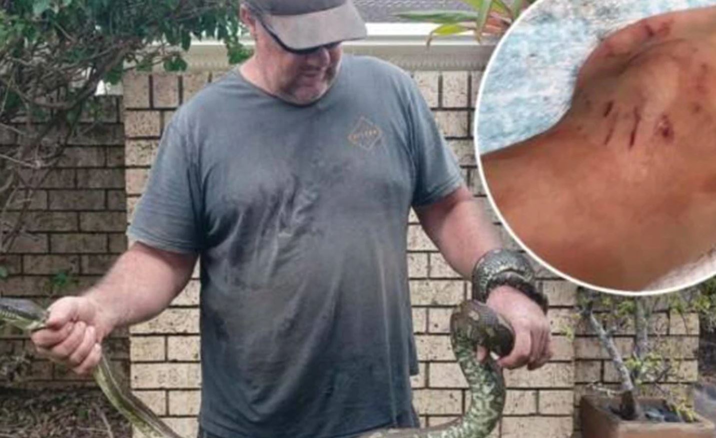 Αυστραλία: 5χρονος δέχθηκε επίθεση από πύθωνα τριών μέτρων-1