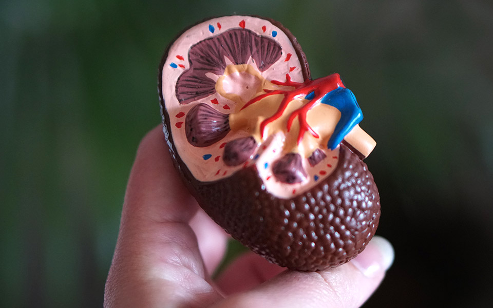 λίθοι-νεφρών-η-επόμενη-μέρα-στη-θεραπε-562138357