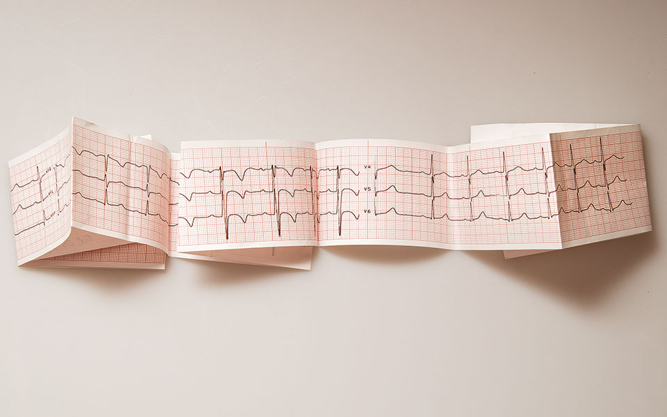 κολπική-μαρμαρυγή-στροφή-σε-στρατηγι-562130092