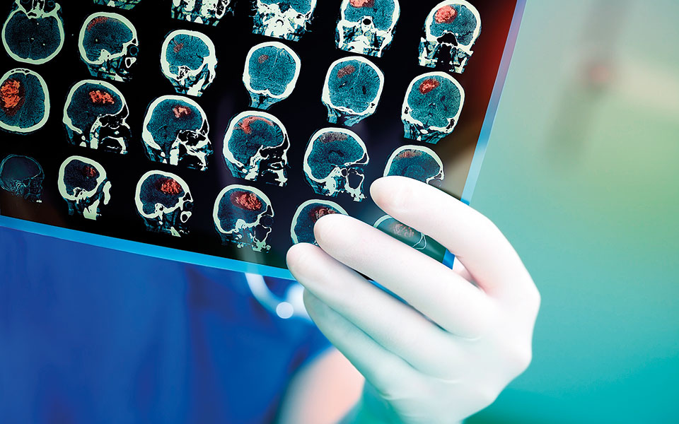 το-μεγάλο-πρόβλημα-των-μικρών-εγκεφαλ-562130575