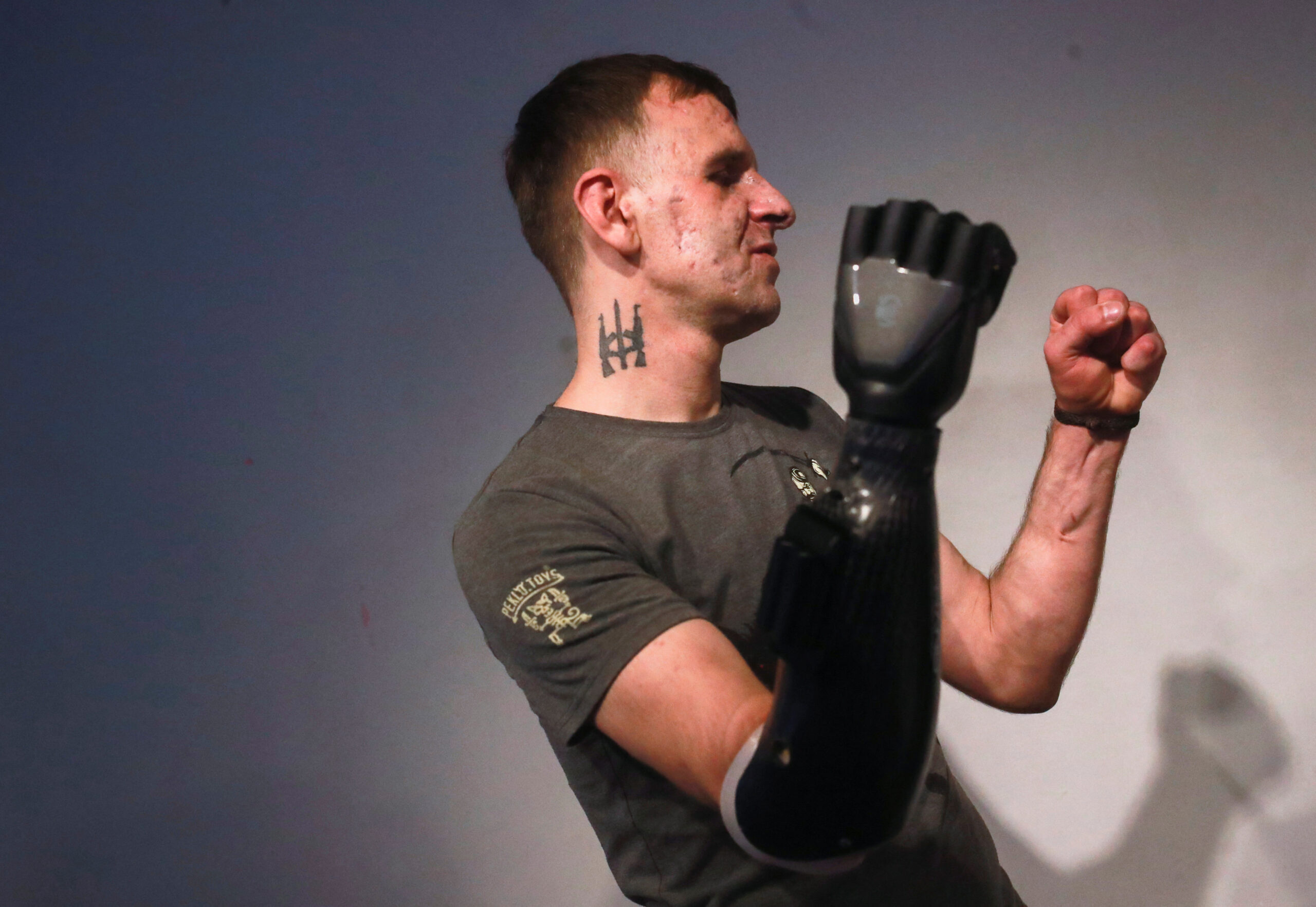 ακρωτηριασμένοι-ουκρανοί-στρατιώτες-562201432