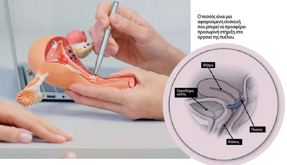 Τι είναι η πρόπτωση των πυελικών οργάνων και πώς θεραπεύεται-1