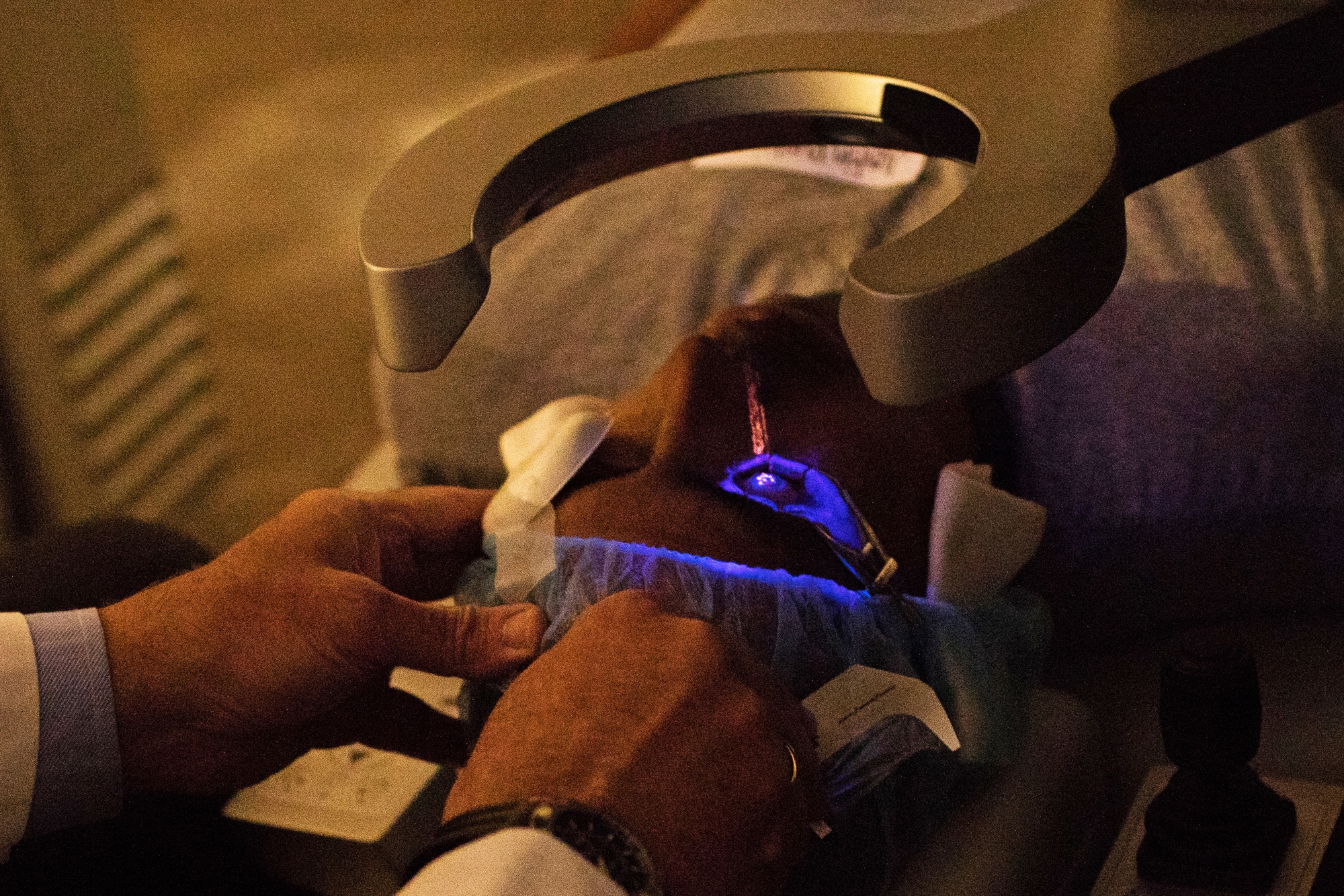 laser-κίνδυνοι-από-την-επέμβαση-για-διόρθω-562179157