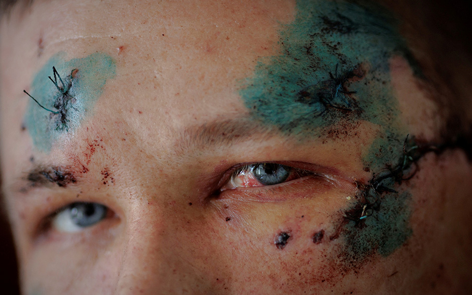 Τα καρέ του πολέμου: Οι 310 ημέρες που συγκλονίζουν τον πλανήτη-8