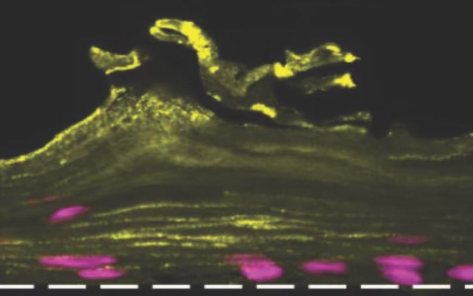 ο-γυναικείος-κόλπος-έγινε-τσιπάκι-απ-562182223