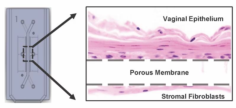 Ο γυναικείος κόλπος έγινε… τσιπάκι από επιστήμονες του Χάρβαρντ-1