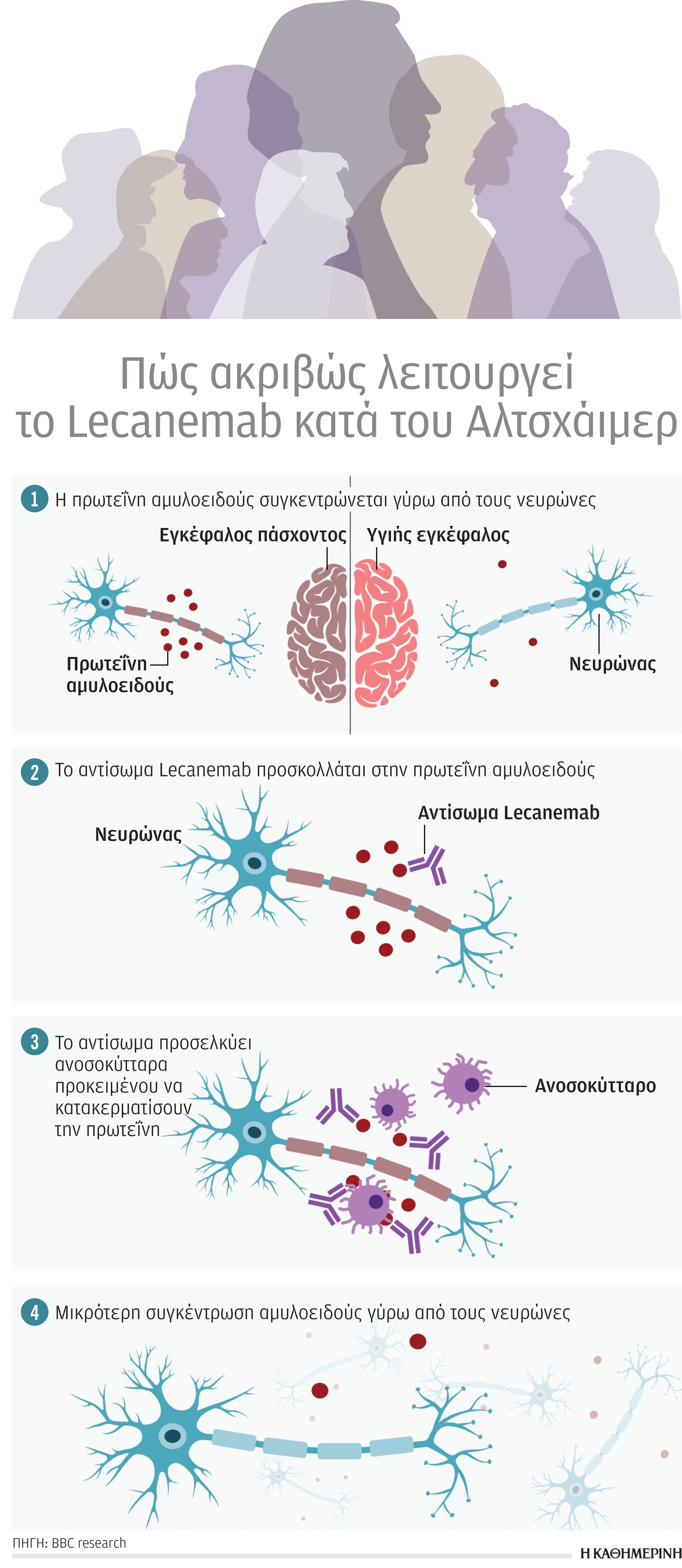 Νόσος Αλτσχάιμερ: Eλπίδες για νέα εποχή και επιφυλάξεις-1