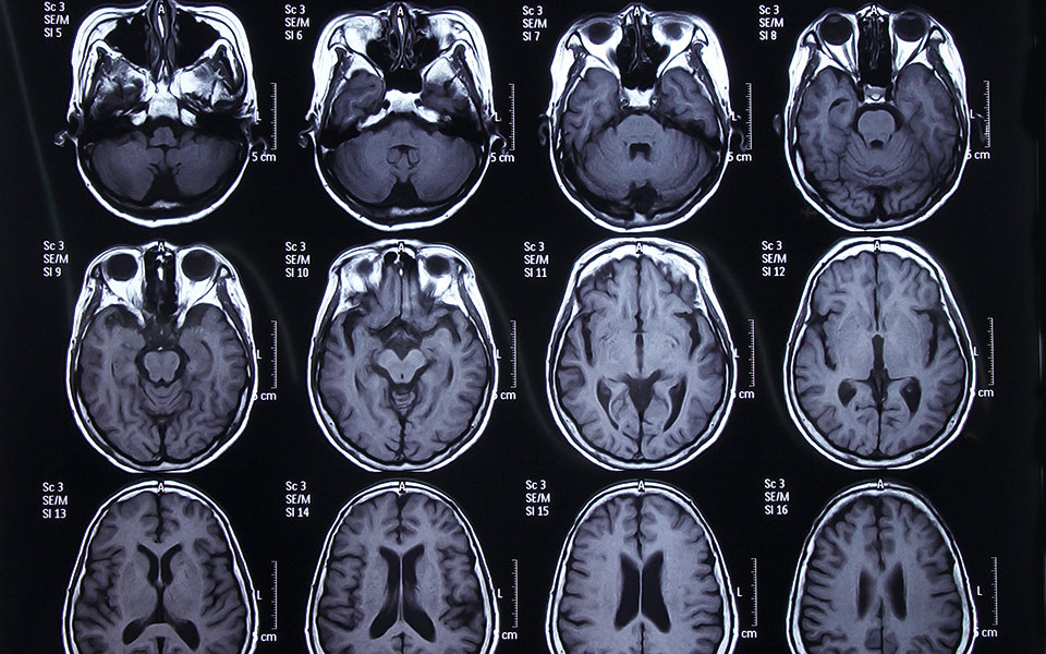 απεικονιστικές-εξετάσεις-από-πότε-κα-562202911