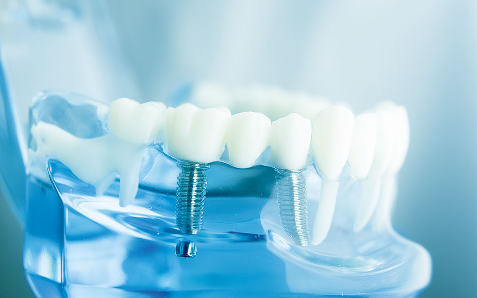 σημαντικές-εξελίξεις-στα-οδοντικά-εμ-562202935