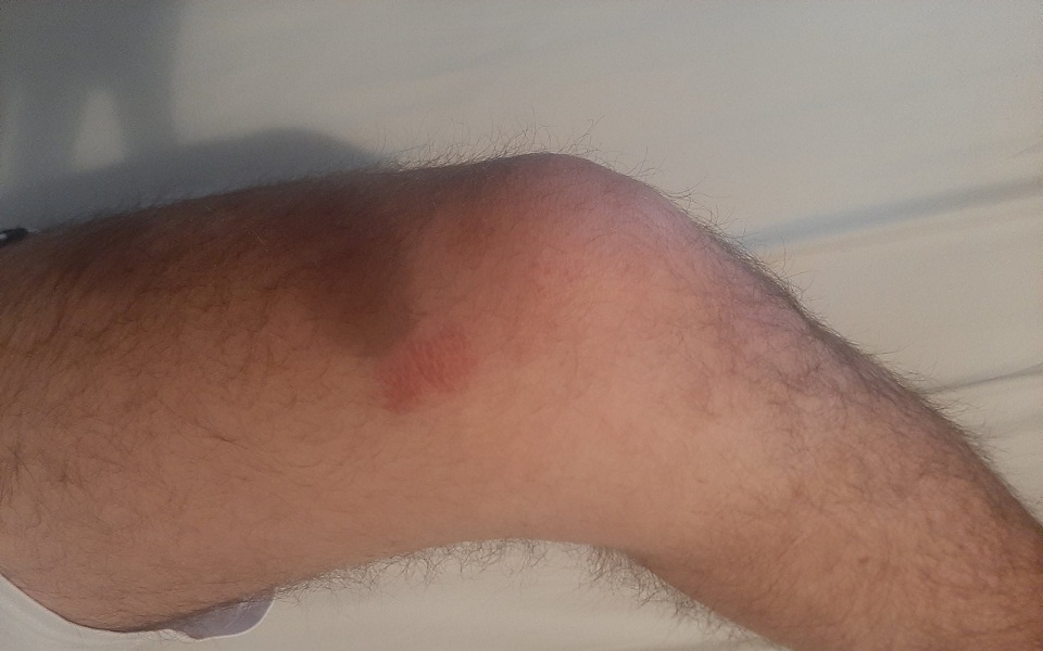 κοσσυφοπέδιο-νέα-επίθεση-αλβανοφώνω-562218319