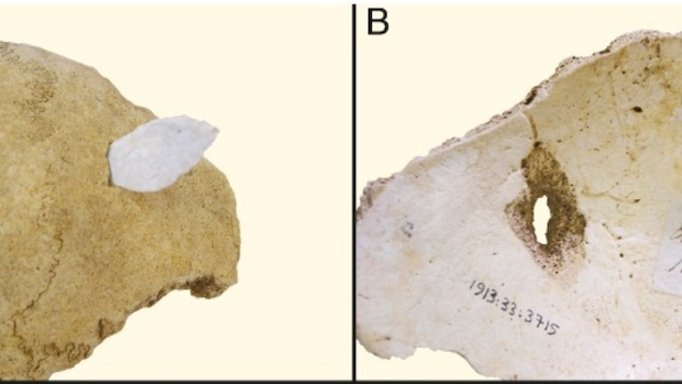 Ο «μύθος» της ειρηνικής νεολιθικής εποχής: Σκελετοί αρχαίων αγροτών αποκαλύπτουν τη βαρβαρότητα-1