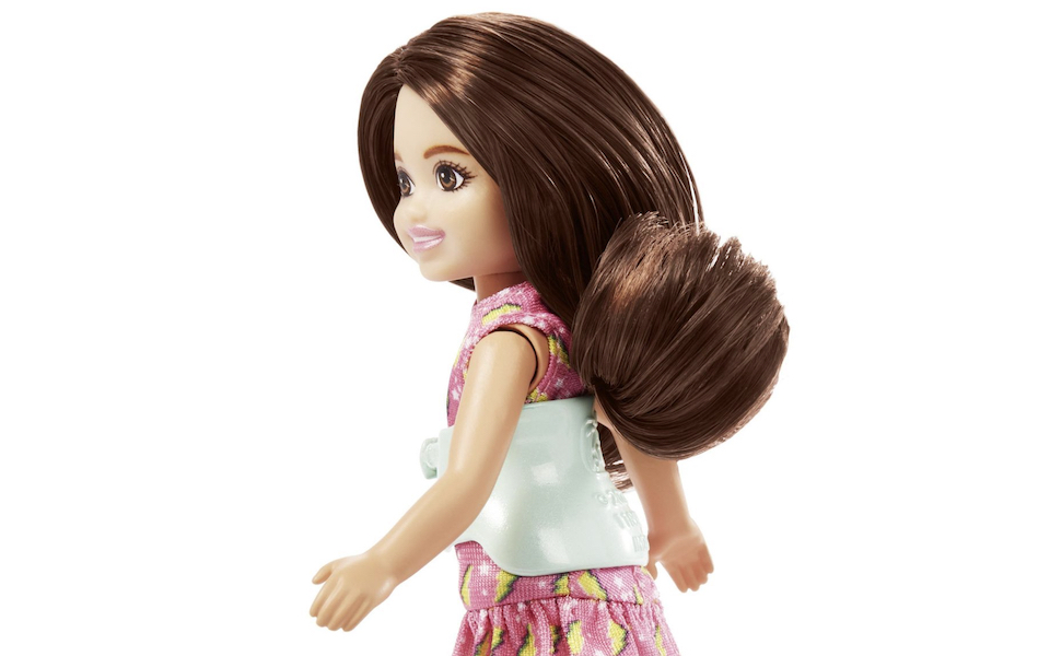 η-μικρή-αδελφή-της-barbie-έχει-σκολίωση-η-πρ-562257526