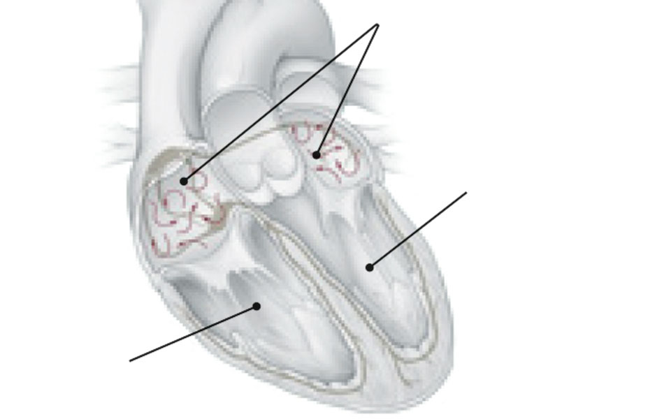 η-άσκηση-φαίνεται-ότι-μειώνει-τον-κίνδ-562345198