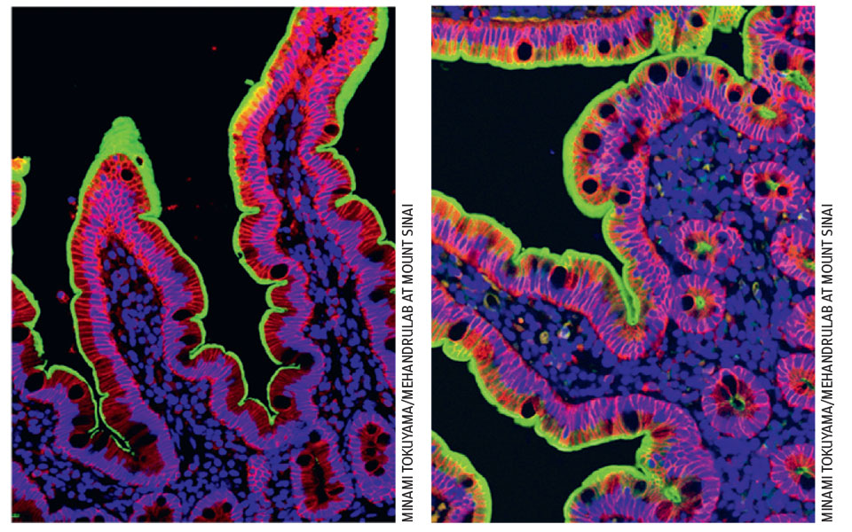 γαστρεντερικά-προβλήματα-στη-long-covid-562312357