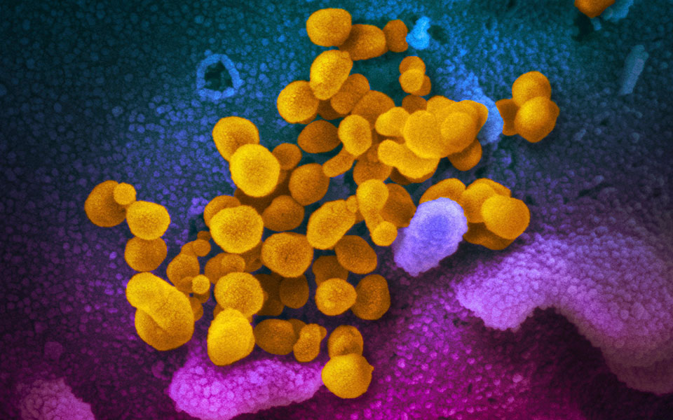 έρευνα-πολύ-λιγότερο-πιθανή-η-μακρά-covid-19-562314184