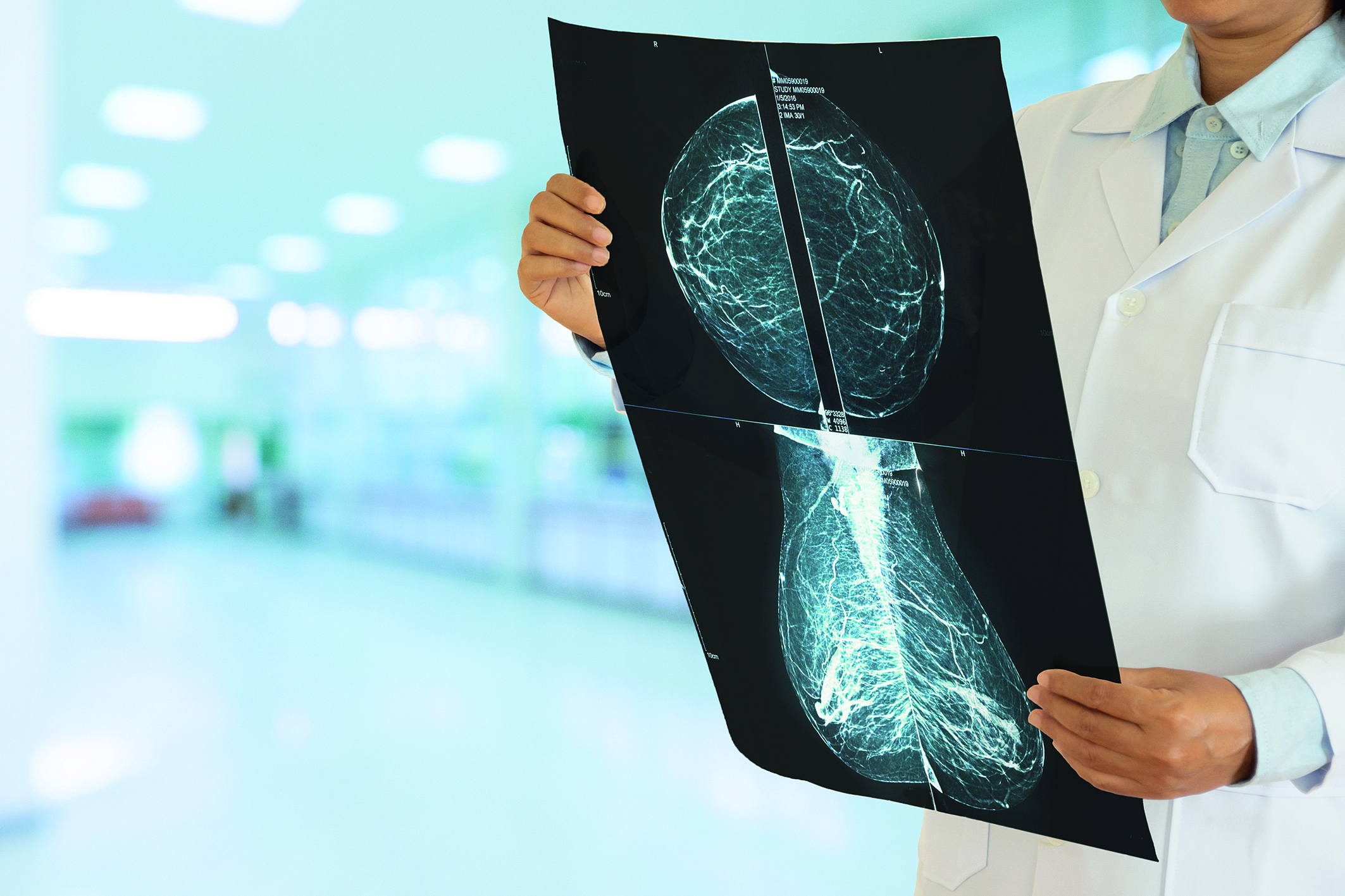 Αν δεν είναι καρκίνος του μαστού, χρειάζεται να ανησυχήσετε;-1