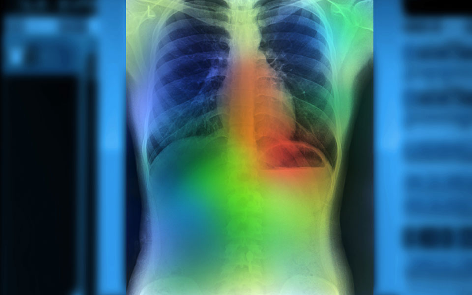 «Ασφαλής διάγνωση από τον “Ευαγγελισμό” μέχρι την Κάρπαθο μέσω τεχνητής νοημοσύνης»-2