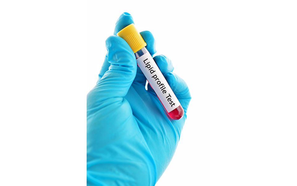 νεότερα-δεδομένα-για-τη-λιποπρωτεΐνη-562387894