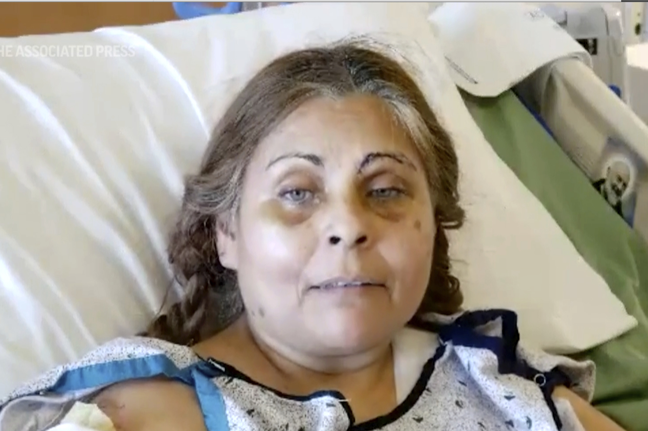 πενσυλβάνια-γυναίκα-σώθηκε-από-έκρηξ-562354366