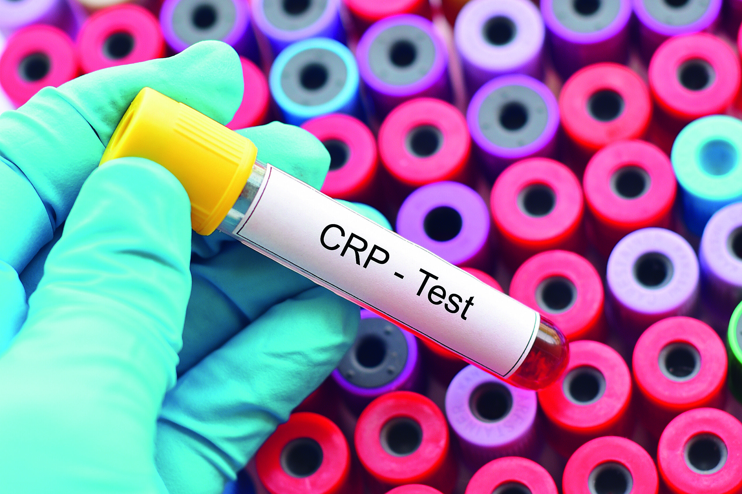 χρειάζεται-να-παρακολουθείτε-αυτόν-τ-562371547