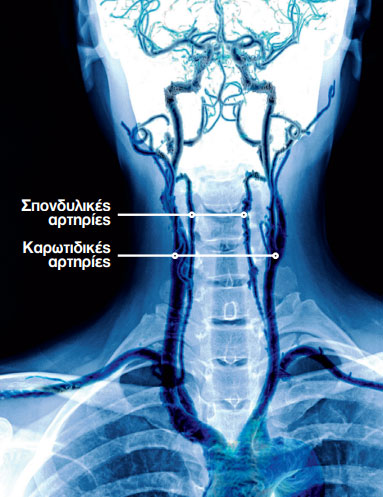 Σοβαρός πόνος στον αυχένα: Μήπως είναι σημάδι μιας κρίσιμης κατάστασης;-1