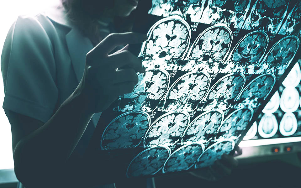 ελπίδα-για-τη-νόσο-αλτσχάιμερ-από-φάρμ-562409815