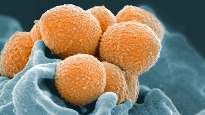 μύθοι-και-αλήθειες-για-τον-στρεπτόκοκ-562470895