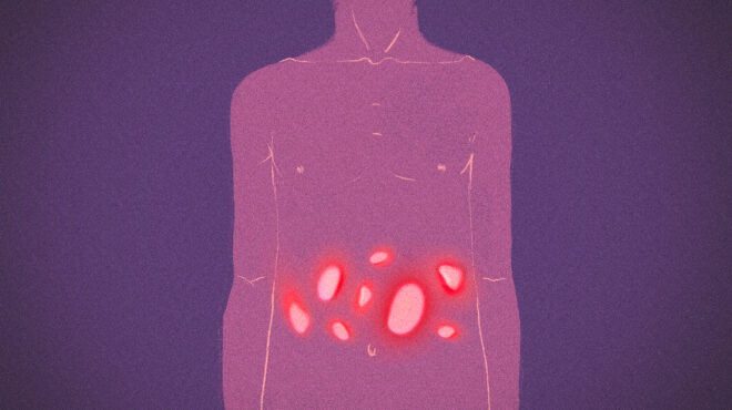 στρες-άγχος-απομόνωση-η-ζωή-με-τη-νόσ-562498507