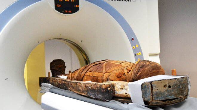 σαρκοφάγοι-στον-αξονικό-τομογράφο-μο-562482433