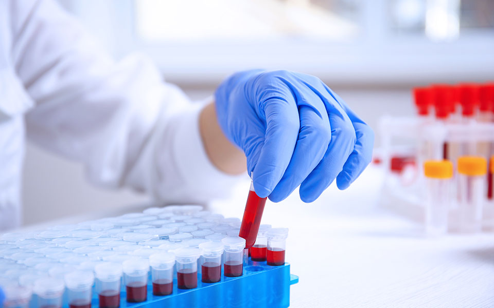 nhs-πολλά-υποσχόμενη-εξέταση-αίματος-γι-562454053