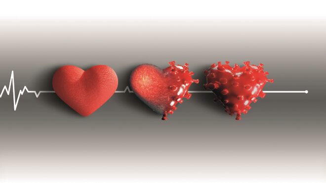 η-καρδιολογική-κληρονομιά-της-covid-19-562513660