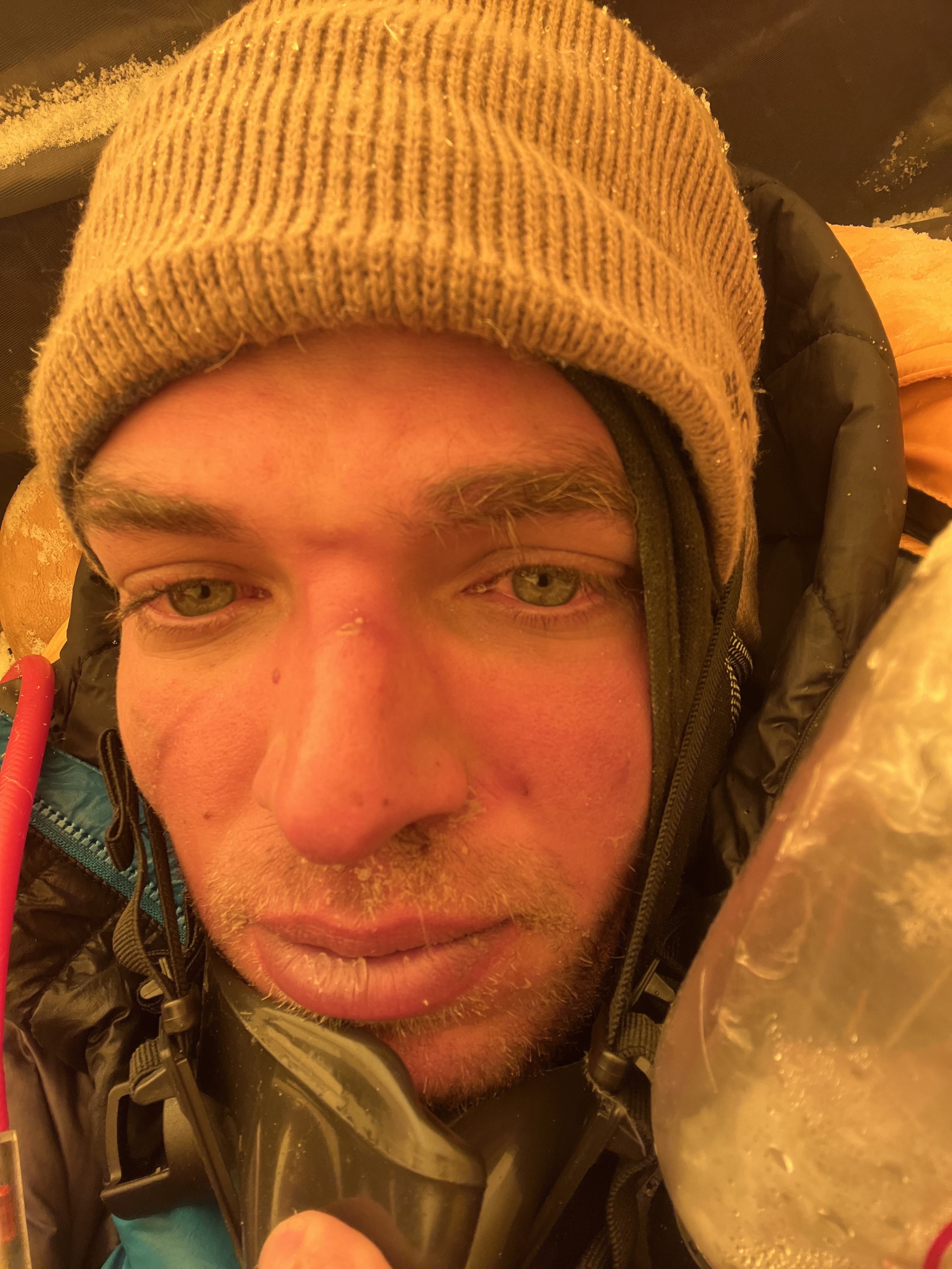 Mάριος Γιαννάκου: «Το τίμημα είναι ο ακρωτηριασμός και το πληρώνω συνειδητά»-3