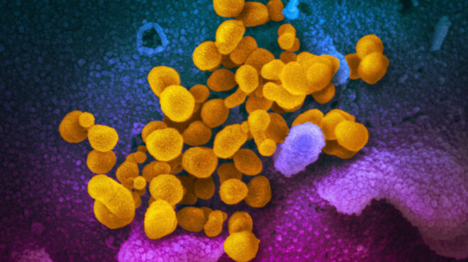 γονιδιακή-παραλλαγή-ευθύνεται-πιθαν-562529197