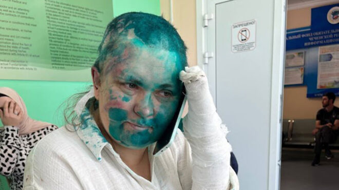 ρωσίδα-δημοσιογράφος-ξυλοκοπήθηκε-α-562504498